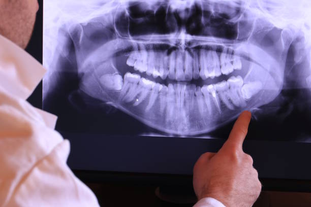 Best Emergency Dental Care for Broken or Chipped Teeth in Gering, NE
